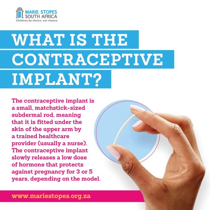 Contraceptive implants